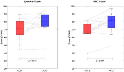 Altered movement strategy during functional movement after an ACL injury, despite ACL reconstruction